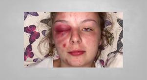 The photo Ellie Williams posted on social media depicting herself with serious facial injuries