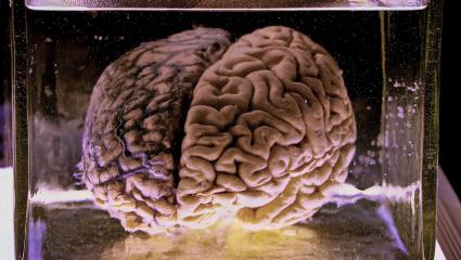 Preserved human brain in a formaldehyde jar