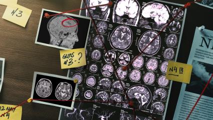 A stock graphic showing brain scans as part of a crime investigation